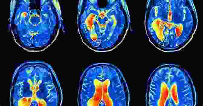 An MRI Scan Of A Healthy Brain, Highlighting The Areas Responsible For Cognitive Function Switch On Your Brain Every Day: 365 Readings For Peak Happiness Thinking And Health