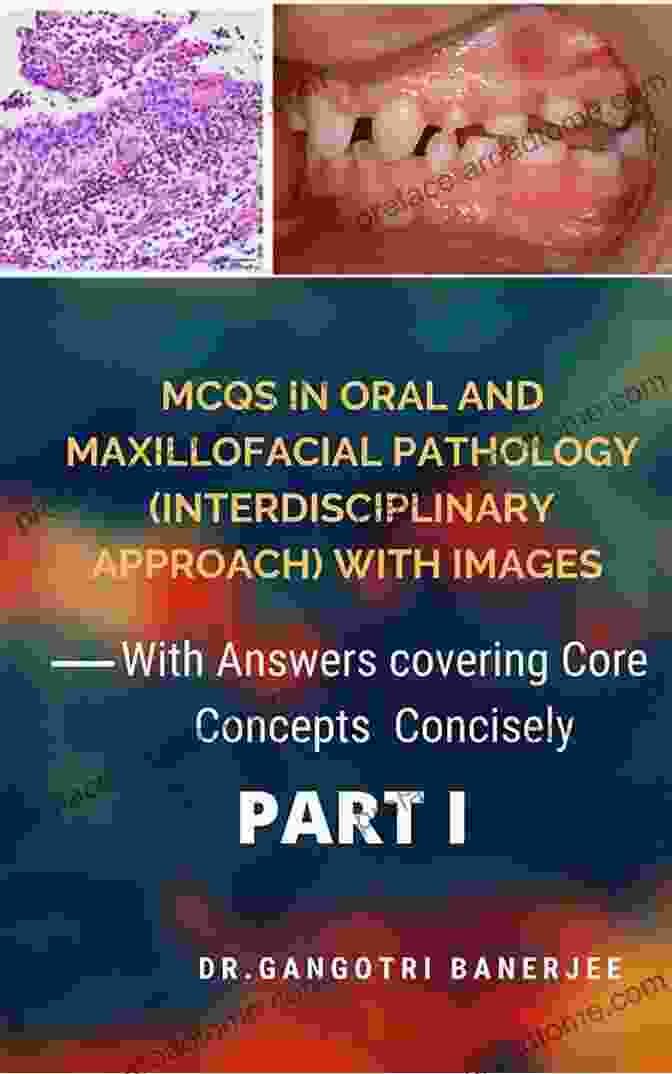 Book Cover Of With Answers Covering Core Concepts Concisely MCQS IN ORAL AND MAXILLOFACIAL PATHOLOGY (INTERDISCIPLINARY APPROACH) WITH IMAGES PART I: WITH ANSWERS COVERING CORE CONCEPTS CONCISELY