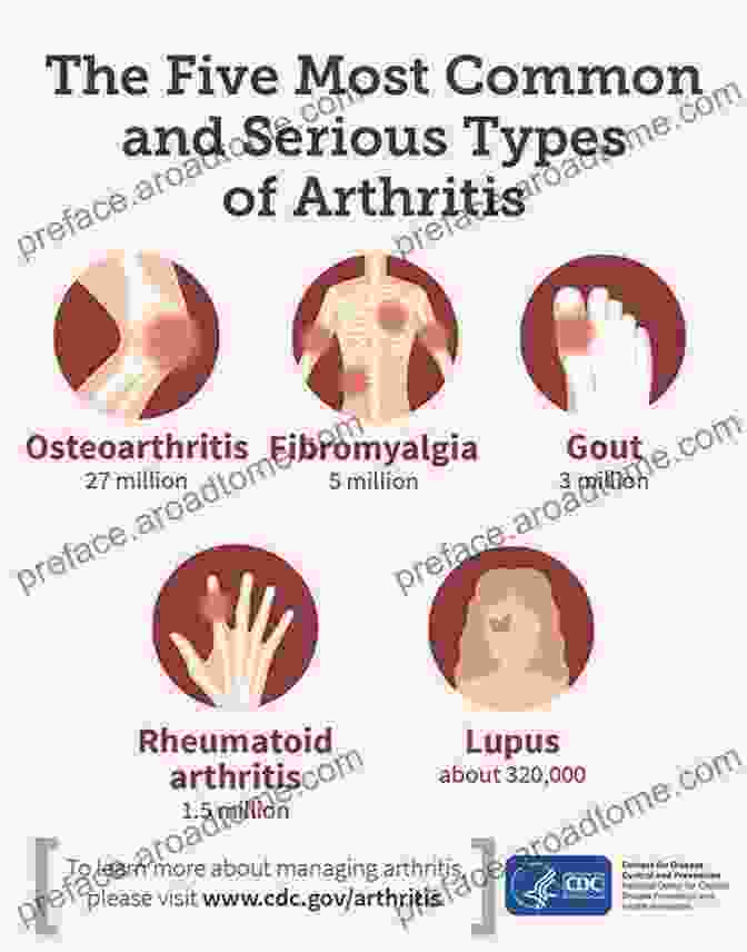 Chart Showing Different Types Of Arthritis User S Guide To Inflammation Arthritis And Aging: Learn How Diet And Supplements Can Reduce Inflammation And Slow The Aging Process (Basic Health Publications User S Guide)