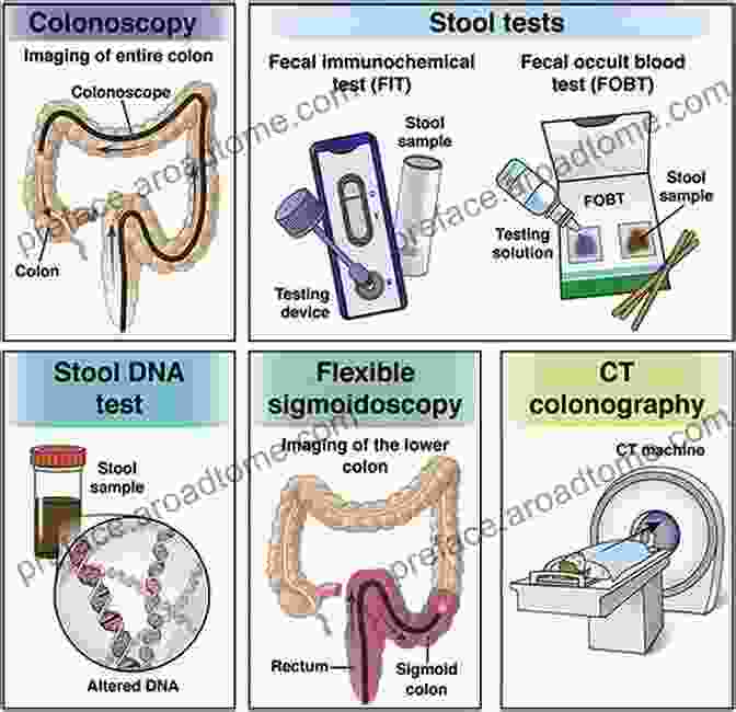 Colonoscopy Procedure For Early Detection Of Colon Cancer The Colon Cancer Diet Dr Christopher J Maloney N D