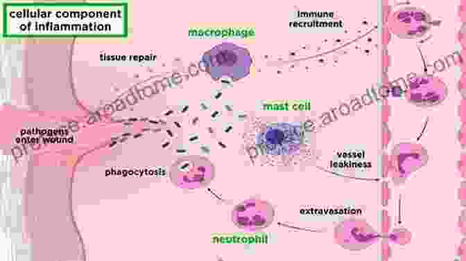 Diagram Of The Inflammatory Process User S Guide To Inflammation Arthritis And Aging: Learn How Diet And Supplements Can Reduce Inflammation And Slow The Aging Process (Basic Health Publications User S Guide)