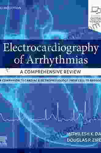 Electrocardiography Of Arrhythmias: A Comprehensive Review: A Companion To Cardiac Electrophysiology