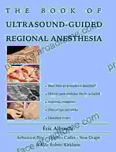 The Of Ultrasound Guided Regional Anesthesia