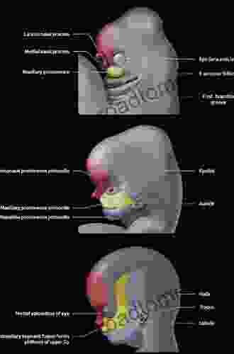 Pediatric Temporomandibular Joint Disorders An Issue of Oral and Maxillofacial Surgery Clinics of North America (The Clinics: Dentistry)